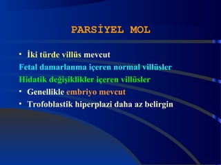 PARSİYEL MOL 
• İki türde villüs mevcut 
Fetal damarlanma içeren normal villüsler 
Hidatik değişiklikler içeren villüsler 
• Genellikle embriyo mevcut 
• Trofoblastik hiperplazi daha az belirgin 
 