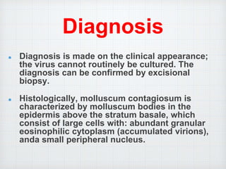 Diagnosis
Diagnosis is made on the clinical appearance;
the virus cannot routinely be cultured. The
diagnosis can be confirmed by excisional
biopsy.
Histologically, molluscum contagiosum is
characterized by molluscum bodies in the
epidermis above the stratum basale, which
consist of large cells with: abundant granular
eosinophilic cytoplasm (accumulated virions),
anda small peripheral nucleus.
 