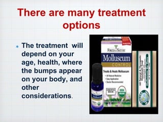 There are many treatment
options
The treatment will
depend on your
age, health, where
the bumps appear
on your body, and
other
considerations.
 