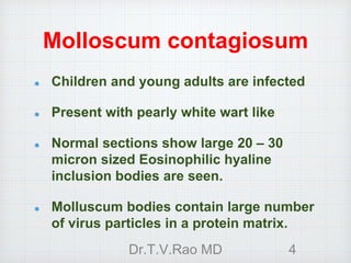 Molloscum contagiosum
Children and young adults are infected
Present with pearly white wart like
Normal sections show large 20 – 30
micron sized Eosinophilic hyaline
inclusion bodies are seen.
Molluscum bodies contain large number
of virus particles in a protein matrix.
Dr.T.V.Rao MD 4
 