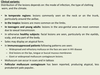 Clinical variants:
Distribution of the lesions depends on: the mode of infection, the type of clothing
worn, and the climate.
• In temperate regions: lesions commonly seen on the neck or on the trunk,
particularly around the axillae.
• In the tropics: lesions are more common on the limbs.
• In teenagers and young adults: lesions in the ano‐genital area are most common
due to sexual transmission.
• In otherwise healthy subjects: facial lesions are seen, particularly on the eyelids,
scalp, and any part of the body.
• Soles may display an atypical form.
• In immunosuppressed patients following patterns are seen:
– Widespread and refractory mollusca on the face are seen in HIV disease
– Oral lesions on the lips, tongue or buccal mucous membranes
– Giant or widespread molluscum contagiosum lesions.
• Molluscum can occur in scars and in tattoos
• Follicular molluscum contagiosum has been reported, producing atypical, less
protuberant pale papules .
 