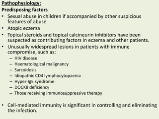 Pathophysiology:
Predisposing factors
• Sexual abuse in children if accompanied by other suspicious
features of abuse.
• Atopic eczema
• Topical steroids and topical calcineurin inhibitors have been
suspected as contributing factors in eczema and other patients.
• Unusually widespread lesions in patients with immune
compromise, such as:
– HIV disease
– Haematological malignancy
– Sarcoidosis
– Idiopathic CD4 lymphocytopaenia
– Hyper‐IgE syndrome
– DOCK8 deficiency
– Those receiving immunosuppressive therapy
• Cell‐mediated immunity is significant in controlling and eliminating
the infection.
 