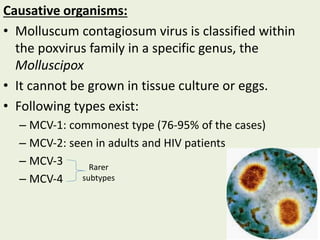 Causative organisms:
• Molluscum contagiosum virus is classified within
the poxvirus family in a specific genus, the
Molluscipox
• It cannot be grown in tissue culture or eggs.
• Following types exist:
– MCV‐1: commonest type (76-95% of the cases)
– MCV‐2: seen in adults and HIV patients
– MCV‐3
– MCV‐4
Rarer
subtypes
 