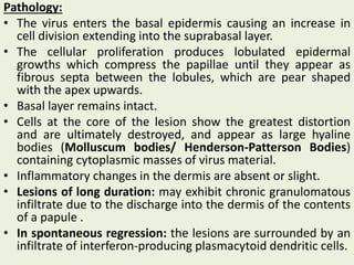 Pathology:
• The virus enters the basal epidermis causing an increase in
cell division extending into the suprabasal layer.
• The cellular proliferation produces lobulated epidermal
growths which compress the papillae until they appear as
fibrous septa between the lobules, which are pear shaped
with the apex upwards.
• Basal layer remains intact.
• Cells at the core of the lesion show the greatest distortion
and are ultimately destroyed, and appear as large hyaline
bodies (Molluscum bodies/ Henderson-Patterson Bodies)
containing cytoplasmic masses of virus material.
• Inflammatory changes in the dermis are absent or slight.
• Lesions of long duration: may exhibit chronic granulomatous
infiltrate due to the discharge into the dermis of the contents
of a papule .
• In spontaneous regression: the lesions are surrounded by an
infiltrate of interferon‐producing plasmacytoid dendritic cells.
 