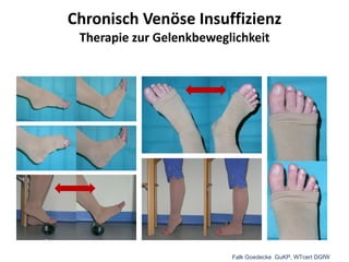 Chronisch Venöse Insuffizienz Therapie zur Gelenkbeweglichkeit Falk Goedecke  GuKP, WTcert DGfW 