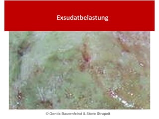 Exsudatbelastung © Gonda Bauernfeind & Steve Strupeit  
