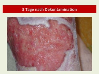 3 Tage nach Dekontamination 