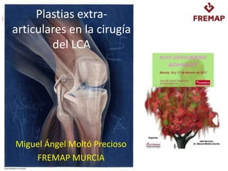 Plastias extra-
articulares en la cirugía
del LCA
Miguel Ángel Moltó Precioso
FREMAP MURCIA
 