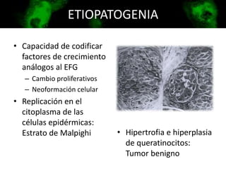 ETIOPATOGENIA
• Capacidad de codificar
factores de crecimiento
análogos al EFG
– Cambio proliferativos
– Neoformación celular
• Replicación en el
citoplasma de las
células epidérmicas:
Estrato de Malpighi • Hipertrofia e hiperplasia
de queratinocitos:
Tumor benigno
 
