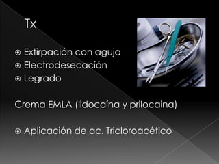  Extirpación con aguja
 Electrodesecación
 Legrado


Crema EMLA (lidocaína y prilocaina)

   Aplicación de ac. Tricloroacético
 