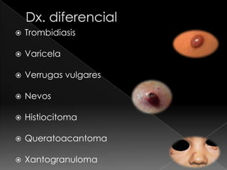    Trombidiasis

   Varicela

   Verrugas vulgares

   Nevos

   Histiocitoma

   Queratoacantoma

   Xantogranuloma
 
