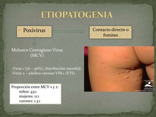  Poxivirus Contacto directo o
fomites
-Virus 1 (76 – 96%), distribución mundial.
-Virus 2 – adultos varones VIH+ (ETS)
Molusco Contagioso Virus
(MCV)
Proporción entre MCV-1 y 2:
niños: 43:1
mujeres: 11:1
varones: 1.3:1
 