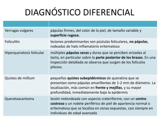 DIAGNÓSTICO DIFERENCIAL
Verrugas vulgares pápulas firmes, del color de la piel, de tamaño variable y
superficie rugosa.
Foliculitis lesiones predominantes son pústulas foliculares, no pápulas,
rodeadas de halo inflamatorio eritematoso
Hiperqueratosis folicular múltiples pápulas secas y duras que se perciben erizadas al
tacto, en particular sobre la parte posterior de los brazos. En una
inspección detallada se observa que surgen de los folículos
pilosos.
Quistes de millium pequeños quistes subepidérmicos de queratina que se
presentan como pápulas amarillentas de 1-2 mm de diámetro. La
localización, más común en frente y mejillas, y su mayor
profundidad, inmediatamente bajo la epidermis
Queratoacantoma lesión redondeada con aspecto crateriforme, con un centro
costroso y un rodete periférico de piel de apariencia normal o
eritematosa que se localiza en zonas expuestas, casi siempre en
individuos de edad avanzada
 