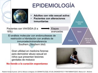 EPIDEMIOLOGÍA
Cualquier
raza
Edad
Sexo
Niños de
10 a 12
años
• Adultos con vida sexual activa
• Pacientes con alteraciones
inmunitarias
Pacientes con VIH/SIDA (5 a
18%)
Etapas
avanzadas
El análisis molecular con endonucleasas de
restricción e hibridación con análisis de
inmunoelectrotransferencia
Southern (Southern blot)
Gran utilidad en medicina forense
para demostrar abuso sexual en
niños que presentan lesiones
genitales de molusco
No tiende a la curación espontanea
Roberto Arenas Guzman. (2013). Molusco contagioso. En DERMATOLOGÍA, ATLAS, DIAGNÓSTICO Y TRATAMIENTO(937). Mexico D.F.: McGraw
 