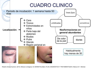 CUADRO CLINICO
 Periodo de incubación: 1 semana hasta 50
días
Localización:
 Cara
 Tronco
 Extremidades en
niños
 Parte baja del
abdomen
 Muslos
 Pubis
 Glande
 Región perianal en
adultos
Neoformaciones en
general abundantes
1mm-3cm
semiesféricas
durasDe color
de la piel
umbilicadas
Habitualmente
hay menos de 30
Roberto Arenas Guzman. (2013). Molusco contagioso. En DERMATOLOGÍA, ATLAS, DIAGNÓSTICO Y TRATAMIENTO(937). Mexico D.F.: McGraw
 