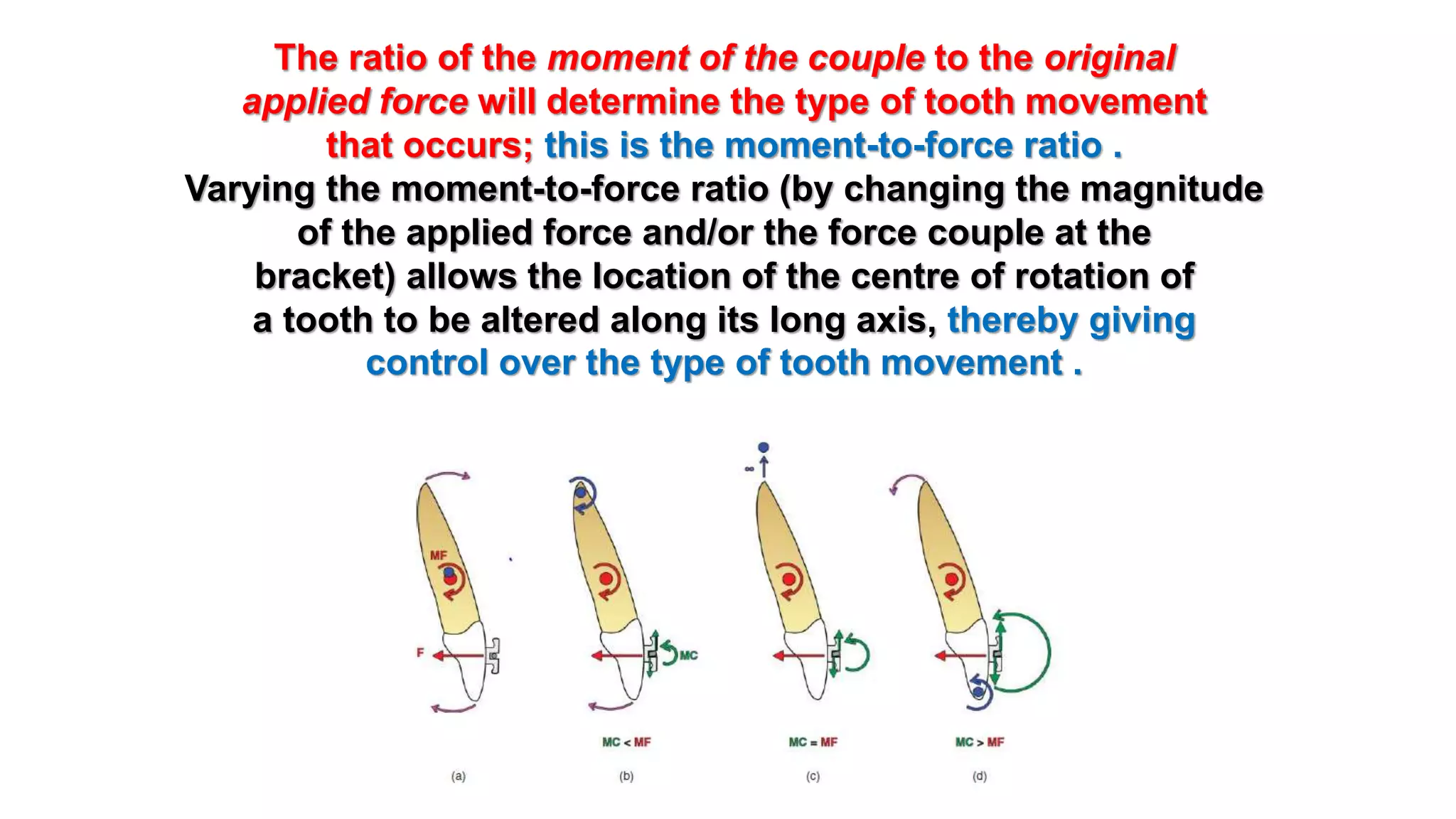 Moment-to-Force Ratios and Controlling RootNew Microsoft PowerPoint ...