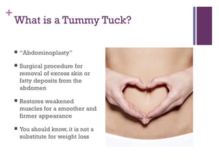 +
What is a Tummy Tuck?
 “Abdominoplasty”
 Surgical procedure for
removal of excess skin or
fatty deposits from the
abdomen
 Restores weakened
muscles for a smoother and
firmer appearance
 You should know, it is not a
substitute for weight loss
 