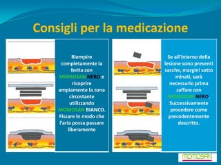 Consigli per la medicazione
           Riempire          Se all’interno della
     completamente la      lesione sono presenti
           ferita con      sacche, margini sotto
    MOMOSAN NERO e              minati, sarà
            ricoprire         necessario prima
    ampiamente la zona           zaffare con
          circostante        MOMOSAN NERO.
          utilizzando         Successivamente
    MOMOSAN BIANCO.           procedere come
    Fissare in modo che      precedentemente
    l’aria possa passare          descritto.
         liberamente
 
