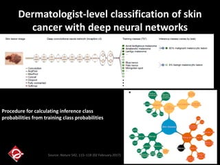 Dermatologist-level classification of skin
cancer with deep neural networks
Procedure for calculating inference class
probabilities from training class probabilities
Source: Nature 542, 115–118 (02 February 2017)
 