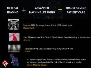 First FDA Approval For Clinical Cloud-Based Deep Learning In Healthcare
Arterys
Prostate MRI: An image is worth the 1000 blood tests.
MaxwellMRI
Deep Learning spots disease early using Chest-X rays
Enlitic
CT scans: Algorithms inform cardiovascular and metabolic state
of patients, and predicts the risk of heart attack and stroke
Zebra Medical Vision
 