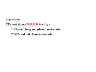 MONDAY BI RADS gvxlhshdslhsdkhsdkhkdu.pptx