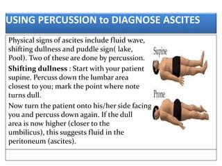 Normal Puddle Sign Monday final abdominal examination final ppt | PPTX