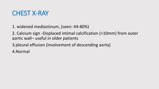 Aortic Dissection | PPTX