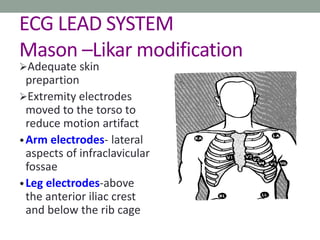 ECG LEAD SYSTEM
Mason –Likar modification
Adequate skin
prepartion
Extremity electrodes
moved to the torso to
reduce motion artifact
•Arm electrodes- lateral
aspects of infraclavicular
fossae
•Leg electrodes-above
the anterior iliac crest
and below the rib cage
 