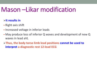 Mason –Likar modification
It results in
• Right axis shift
• Increased voltage in inferior leads
• May produce loss of inferior Q waves and development of new Q
waves in lead aVL
Thus, the body torso limb lead positions cannot be used to
interpret a diagnostic rest 12-lead ECG
 