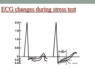 ECG changes during stress test
 