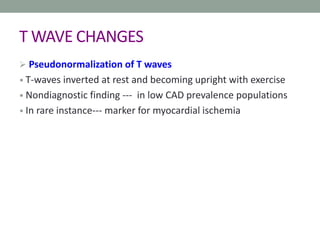 T WAVE CHANGES
 Pseudonormalization of T waves
• T-waves inverted at rest and becoming upright with exercise
• Nondiagnostic finding --- in low CAD prevalence populations
• In rare instance--- marker for myocardial ischemia
 