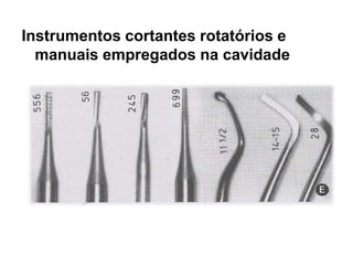 Instrumentos cortantes rotatórios e
  manuais empregados na cavidade
 