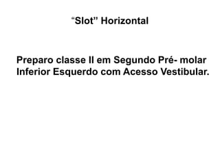 “Slot” Horizontal



Preparo classe II em Segundo Pré- molar
Inferior Esquerdo com Acesso Vestibular.
 
