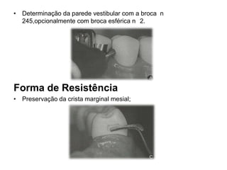 • Determinação da parede vestibular com a broca n
  245,opcionalmente com broca esférica n 2.




Forma de Resistência
• Preservação da crista marginal mesial;
 