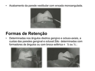 • Acabamento da parede vestibular com enxada monoangulada.




Formas de Retenção
• Determinadas nos ângulos diedros gengivo e ocluso-axiais, a
  custas das paredes gengival e oclusal.São determinadas com
  formadores de ângulos ou com broca esférica n ¼ ou ½ ;
 