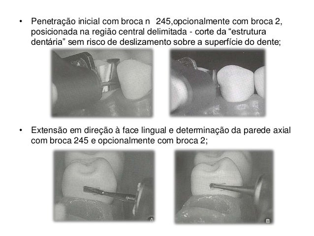 slot vertical y horizontal