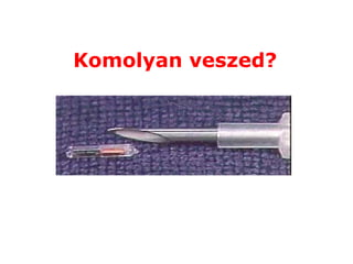 Komolyan veszed ? 