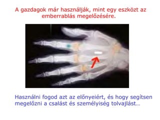 Használni fogod azt az előnyeiért, és hogy segítsen megelőzni a csalást és személyiség tolvajlást… A gazdagok már használják, mint egy eszközt az emberrablás megelőzésére.  