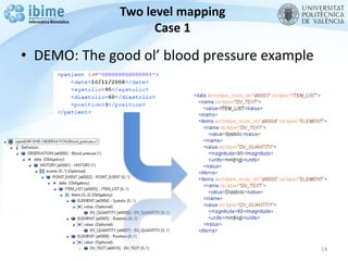 Two level mapping
Case 1
• DEMO: The good ol’ blood pressure example
14
 