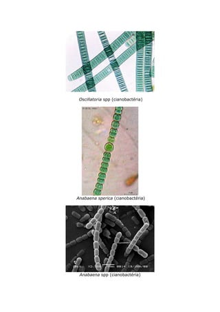 Oscillatoria spp (cianobactéria)




Anabaena sperica (cianobactéria)




 Anabaena spp (cianobactéria)
 