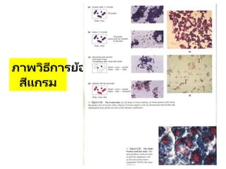 ภาพวิธีการย้อม
สีแกรม
 