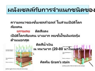 ผนังเซลล์กับการจาแนกชนิดของ
ความหนาของชั้นเซลล์วอลล์ ในส่วนเป็ ปติโดก
ลัยแคน
แกรมลบ ติดสีแดง
เป็ ปติโดกลัยแคน บางมาก พบชั้นไขมันห่อหุ้ม
ด้านนอกสุด
แกรมบวก ติดสีน้าเงิน
เป็ ปติโดกลัยแคน หนามาก (20-80 นาโนเมตร)
ไม่พบชั้นไขมัน
คิดค้น Gram’s stain
 
