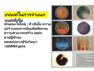 เกณฑ์ในการจาแนก
แบคทีเรีย
ลักษณะโคโลนี : สี เส้นใย ความทึบแสง
รูปร่างและการย้อมติดสีแกรม
ความสามารถสร้าง toxin
ยาปฏิชีวนะ
ทดสอบทางซีรัมวิทยา
-16SRNA gene
 
