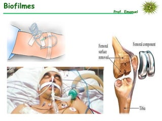 Prof. Emanuel
Biofilmes
 