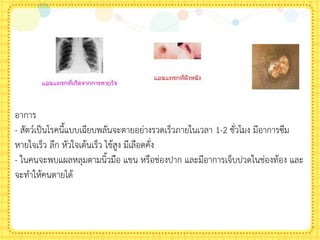 อาการ
- สัตว์เป็นโรคนีแบบเฉียบพลันจะตายอย่างรวดเร็วภายในเวลา 1-2 ชั่วโมง มีอาการซึม
หายใจเร็ว ลึก หัวใจเต้นเร็ว ไข้สูง มีเลือดคั่ง
- ในคนจะพบแผลหลุมตามนิวมือ แขน หรือช่องปาก และมีอาการเจ็บปวดในช่องท้อง และ
จะท้าให้คนตายได้
 