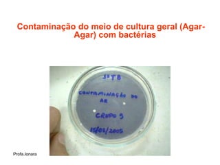 Contaminação do meio de cultura geral (Agar-
             Agar) com bactérias




Profa.Ionara
 