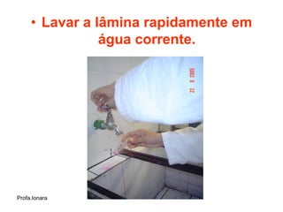 • Lavar a lâmina rapidamente em
                água corrente.




Profa.Ionara
 