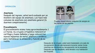 OPERACIÓN
Anestesia
Después del ingreso, usted será evaluado por un
miembro del equipo de anestesia. Los tipos más
comunes de anestesia son anestesia general (lo
duermen completamente)
Procedimiento
El procedimiento mismo toma aproximadamente 1
a 2 horas. Su cirujano ortopédico removerá el
cartílago y hueso dañados y luego colocará los
nuevos implantes de metal, plástico y cerámica
para restablecer la alineación y función de su
rodilla.
Pueden desarrollarse coágulos de sangre en
las venas de las piernas
Después de la cirugía, usted será trasladado a la sala de
recuperación donde permanecerá durante varias horas
mientras se monitorea su recuperación de la anestesia.
Después que se despierte, será llevado a su habitación
del hospital.
 