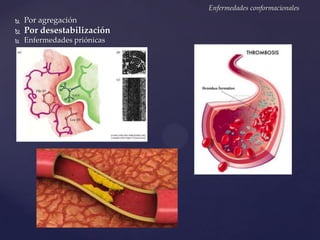 Enfermedades conformacionales


Por agregación



Por desestabilización



Enfermedades priónicas

 