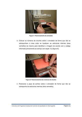 Instrutivo do Programa Estadual de Controle de Qualidade em Mamografia Página 19
Figura 7: Posicionamento do simulador
iii. Colocar os números de chumbo sobre o simulador de forma que não se
sobreponham à área onde se localizam as estruturas internas (área
vermelha) do mesmo para identificar a imagem de acordo com o código
informado previamente ao serviço (ver seção b)) (figura 8);
Figura 8: Posicionamento dos números de chumbo
iv. Posicionar a peça de acrílico sobre o simulador de forma que não se
sobreponha às estruturas internas (área vermelha);
 